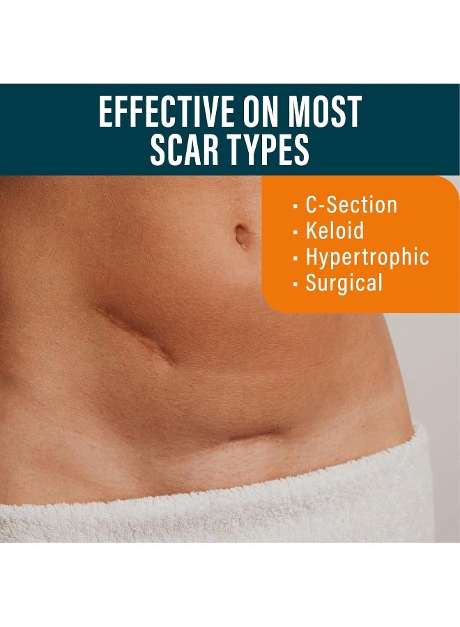 Nuvadermis Silicone Scar Sheets - Dermatologically Tested In Usa - As Surgical Cream, Gel, Tape, Strips, Patches - Keloid, C-Section, Tummy Tuck - Surgery Scars Removal Treatment - 4 Pack 5.7"X1.57" - Image 4